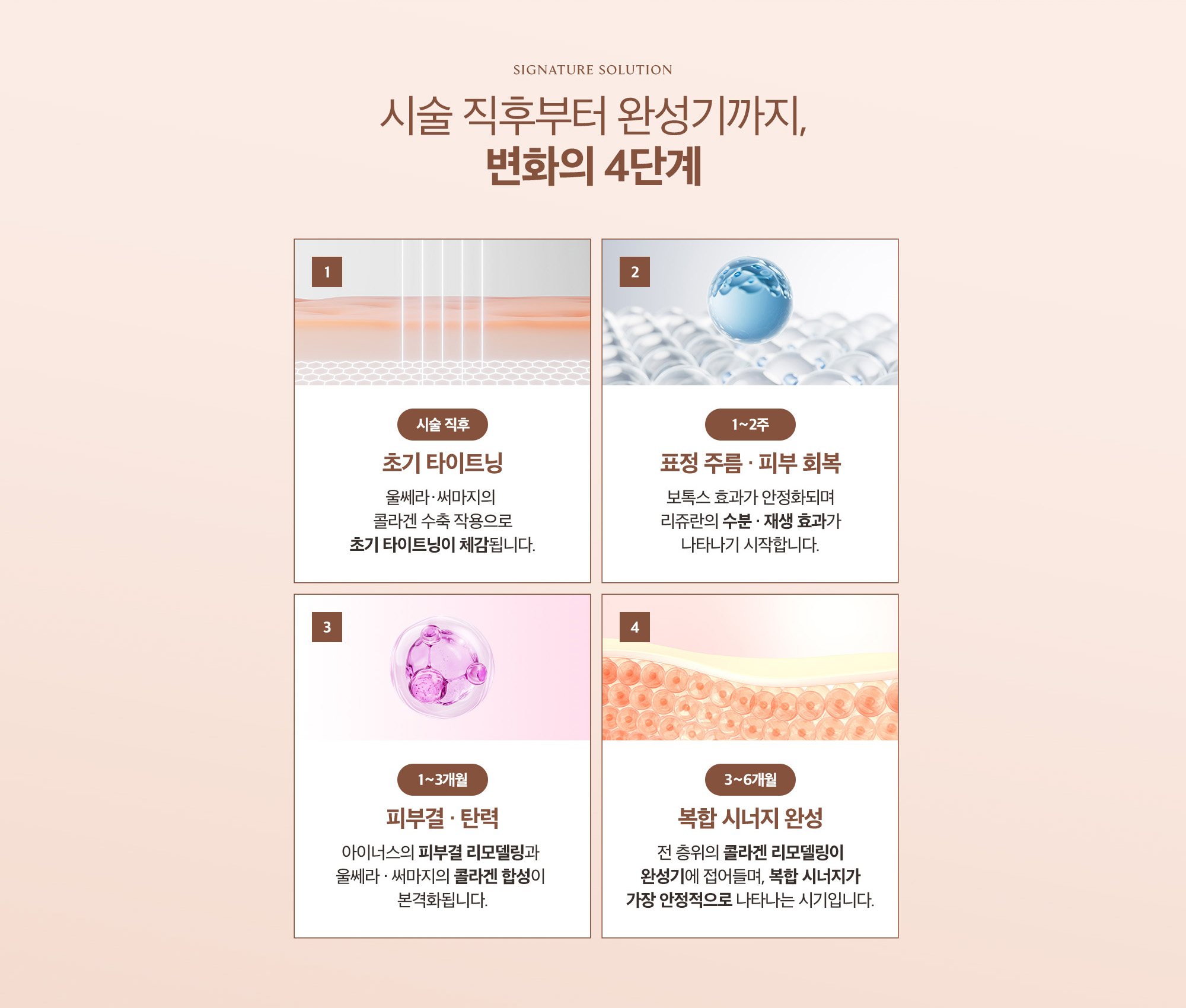 [시술 직후부터 완성기까지, 변화의 4단계] 시술 직후 : 초기 타이트닝 → 1~2주 : 표정 주름 · 피부 회복 → 1~3개월 : 피부결 · 탄력 → 3~6개월 : 복합 시너지 완성