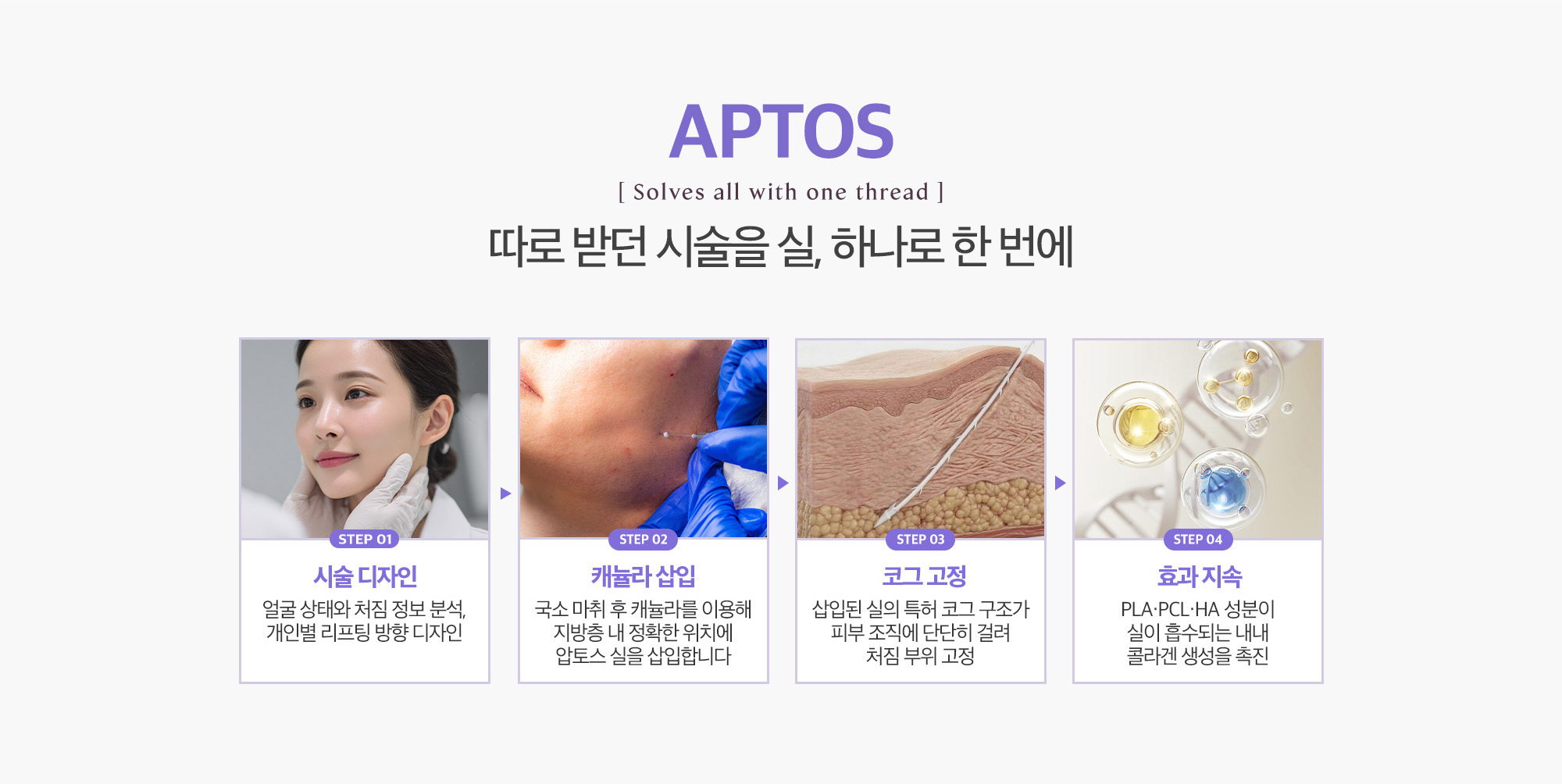 [압토스 시술 방법] STEP 01 : 시술 디자인 → STEP 02 : 캐뉼라 삽입 → STEP 03 : 코그 고정 → STEP 04 : 효과 지속