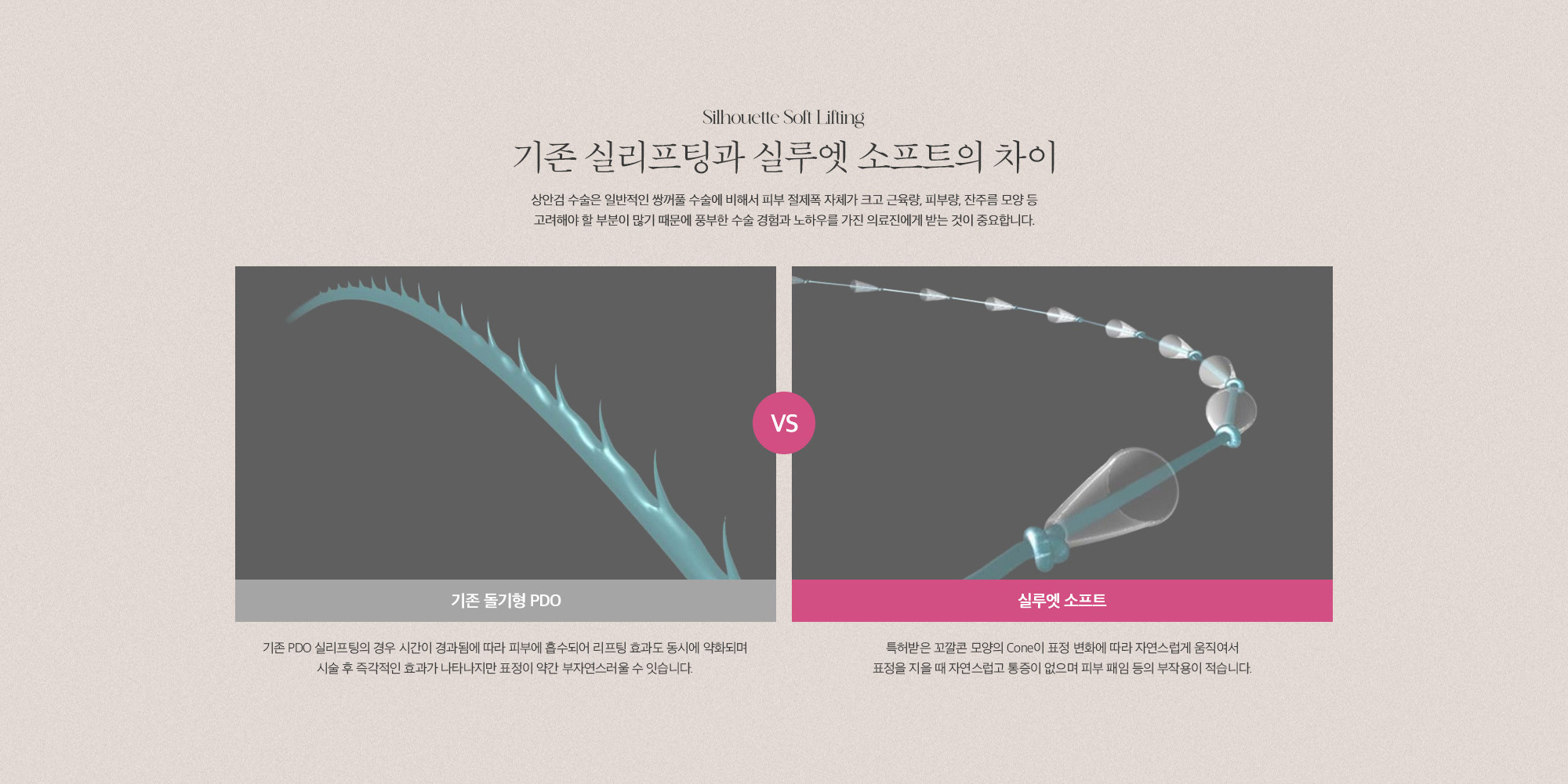 [기존 실리프팅과 실루엣 소프트의 차이] 기존 PDO 실리프팅은 시술 후 즉각적인 효과가 나타나지만 표정이 부자연스러울 수 있는 반면 실루엣 소프트는 특허받은 꼬깔 형태의 cone이 표정 변화에 따라 자연스럽게 움직여 통증이 없으며 피부 패임 등의 부작용이 적습니다.